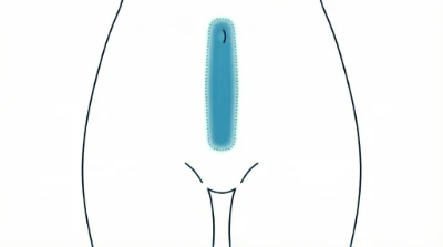 Diagram for Linea alba