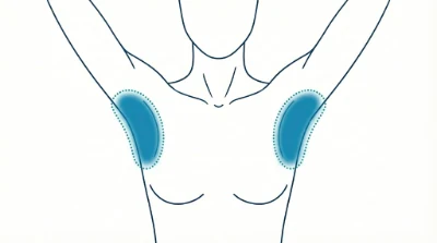 Diagram for Underarms