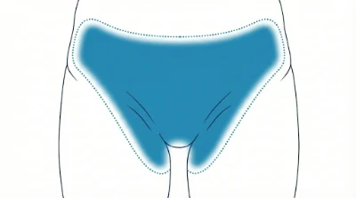 Diagram for Classic bikini