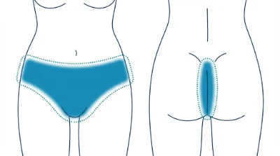 Diagram for Total bikini