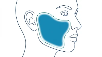 Diagram for Cheeks
