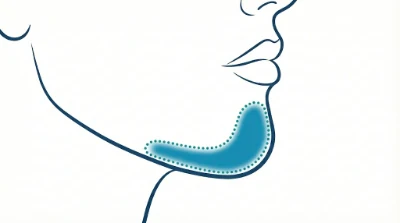 Diagram for Chin
